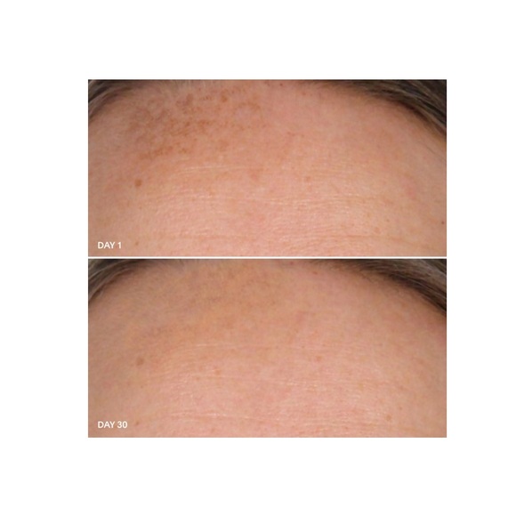 U Beauty Resurfacing Compound - Picture 4 of 5